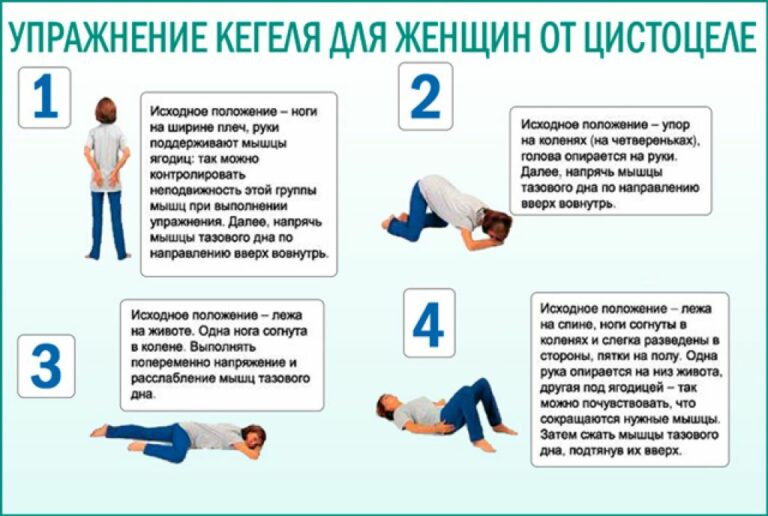 Упражнения Кегеля для мужчин и женщин | «Санталь Геленджик»